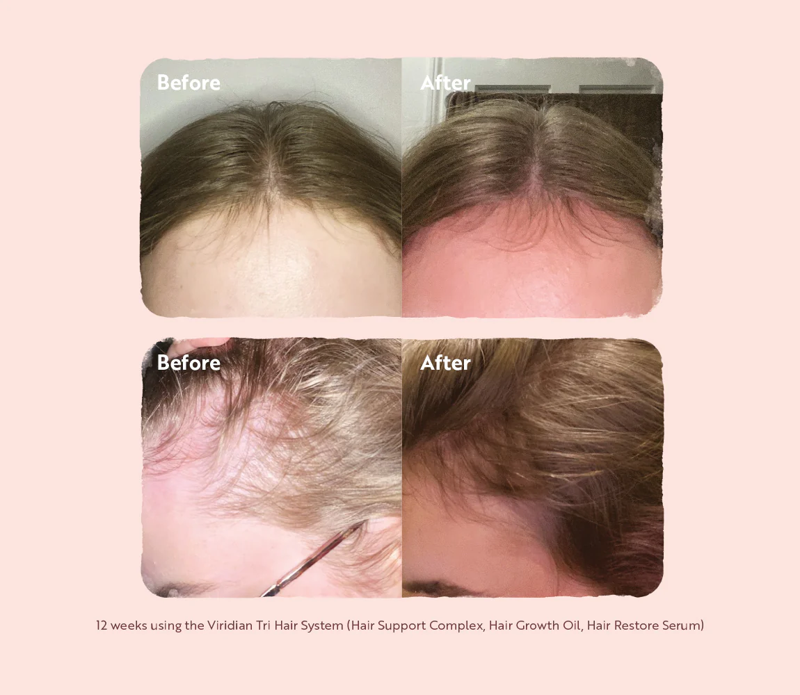 Tri-Hair System Box Set - Image 3
